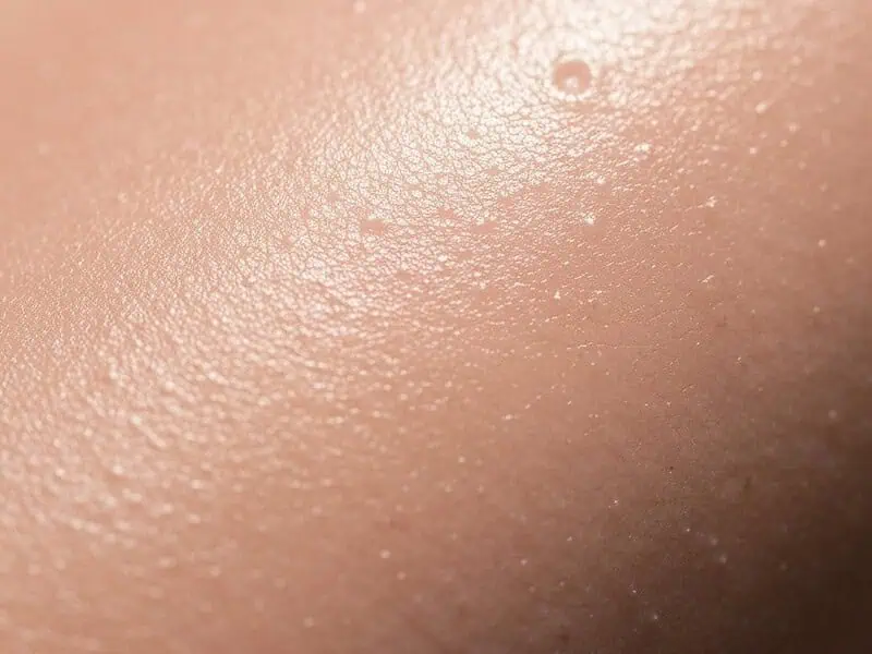 Blefaroplastyka: odzyskaj młody wygląd powiek